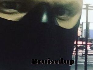 Bruisedup